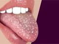 Zapytaj stomatologa: Biały nalot, ból i uczucie dyskomfortu w jamie ustnej? Sprawdź czy to coś poważnego!